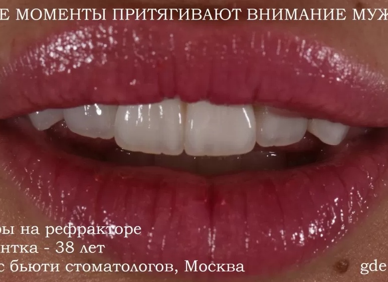 Московские мужчины в поисках цветов к 8 марта пошли на штурм Рижского рынка